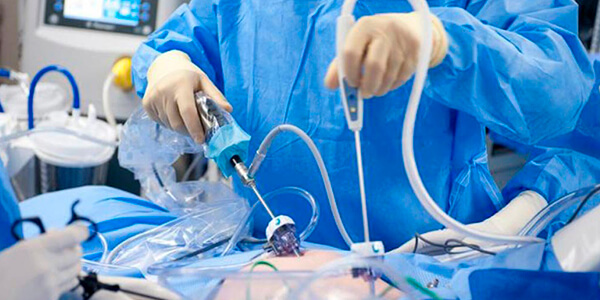 laparoscopy-nephrectomy